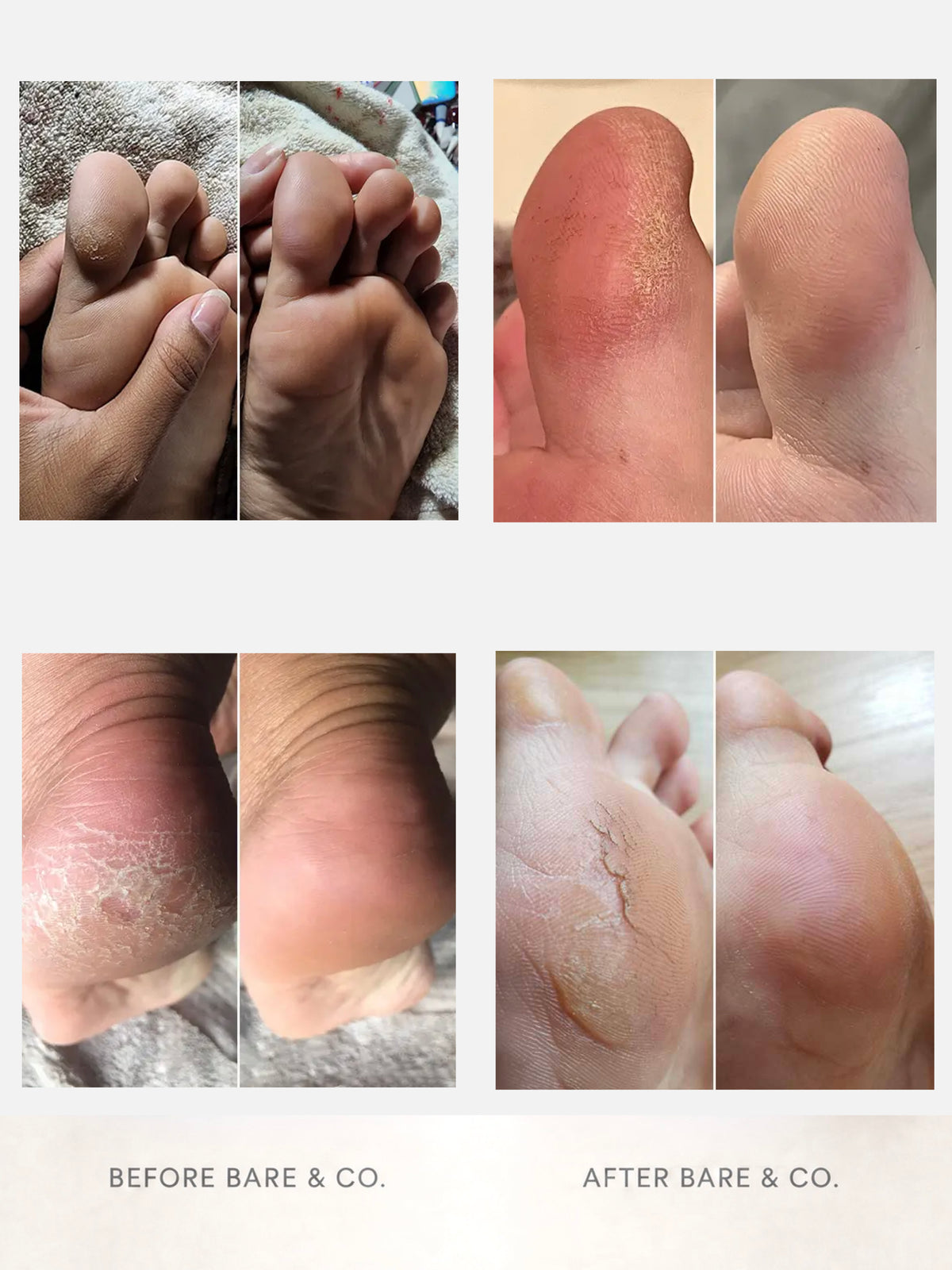 Bare & Co. Electric Foot File